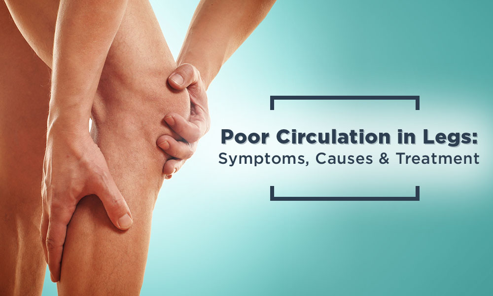 Poor Circulation in Legs: Symptoms, Causes & Treatment